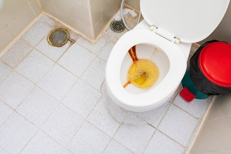 How to Prevent Rust Stains in Your Toilet